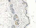COL7A1 Antibody in Immunohistochemistry (Paraffin) (IHC (P))