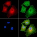 COL8A1 Polyclonal Antibody