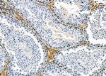 COL16A1 Antibody in Immunohistochemistry (Paraffin) (IHC (P))