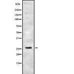 CIDEC Antibody in Western Blot (WB)