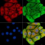 CDK5RAP1 Polyclonal Antibody