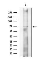 CDK5RAP1 Antibody in Western Blot (WB)