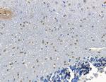 CDCA7L Antibody in Immunohistochemistry (Paraffin) (IHC (P))