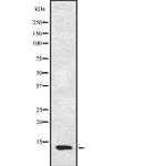 FAM215A Antibody in Western Blot (WB)