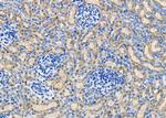 COX3 Antibody in Immunohistochemistry (Paraffin) (IHC (P))