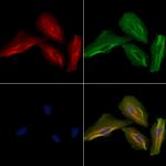 CYP27C1 Polyclonal Antibody