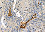 CYP27C1 Antibody in Immunohistochemistry (Paraffin) (IHC (P))