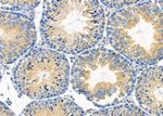 COX7C Polyclonal Antibody