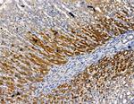 CYP4F8 Polyclonal Antibody
