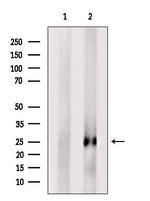 FGF11 Polyclonal Antibody