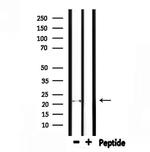 FGF6 Polyclonal Antibody