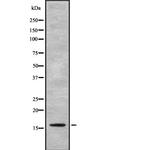 FKSG2 Antibody in Western Blot (WB)