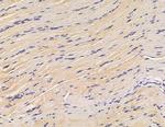 GTSE1 Antibody in Immunohistochemistry (Paraffin) (IHC (P))