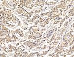 HSBP1 Polyclonal Antibody