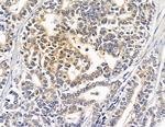 HSBP1 Antibody in Immunohistochemistry (Paraffin) (IHC (P))