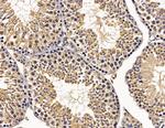 HSBP1 Antibody in Immunohistochemistry (Paraffin) (IHC (P))