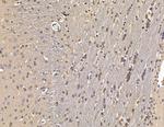 HSBP1 Antibody in Immunohistochemistry (Paraffin) (IHC (P))