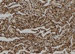 ICEBERG Antibody in Immunohistochemistry (Paraffin) (IHC (P))