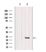Interferon alpha-10 Polyclonal Antibody