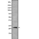 IFNA14 Antibody in Western Blot (WB)