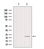 IFNA17 Antibody in Western Blot (WB)