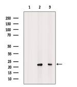 Interferon alpha-21 Polyclonal Antibody