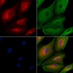 IFIT1B Antibody in Immunocytochemistry (ICC/IF)