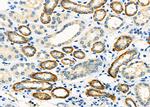 IGFL3 Polyclonal Antibody