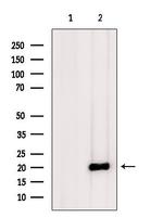 IGFL3 Antibody in Western Blot (WB)