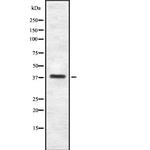 ITGB1BP2 Antibody in Western Blot (WB)