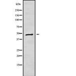 K1H1 Polyclonal Antibody