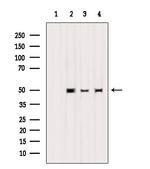 Keratin 32 Antibody in Western Blot (WB)