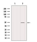 Cytokeratin 34 Polyclonal Antibody