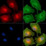 Cytokeratin 35/37/38 Antibody in Immunocytochemistry (ICC/IF)