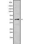 Cytokeratin 35/37/38 Antibody in Western Blot (WB)