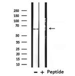Cytokeratin 3 Polyclonal Antibody