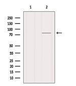 MAGEC3 Antibody in Western Blot (WB)