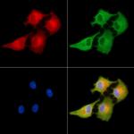 MAGEF1 Polyclonal Antibody