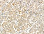 MYL6B Antibody in Immunohistochemistry (Paraffin) (IHC (P))