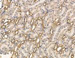 MYL6B Antibody in Immunohistochemistry (Paraffin) (IHC (P))