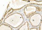 MOZ Polyclonal Antibody