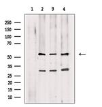 PDCD7 Polyclonal Antibody
