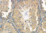 PDCD2L Antibody in Immunohistochemistry (Paraffin) (IHC (P))