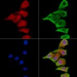 PLCH2 Polyclonal Antibody