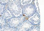 PLCH2 Antibody in Immunohistochemistry (Paraffin) (IHC (P))