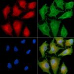 ALPPL2 Polyclonal Antibody