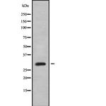 CENPK Antibody in Western Blot (WB)