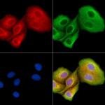 HUS1B Polyclonal Antibody