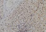 MYCNOS Antibody in Immunohistochemistry (Paraffin) (IHC (P))