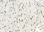 MYCNOS Antibody in Immunohistochemistry (Paraffin) (IHC (P))